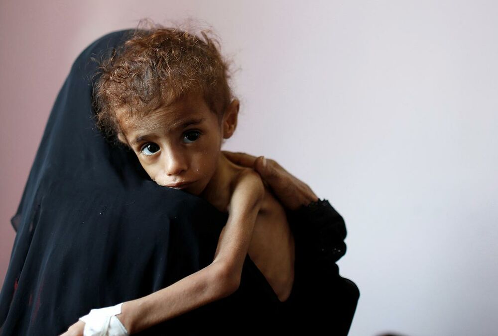 Ємен опинився на порозі гіршого голоду за останні десятиліття, - генсек ООН