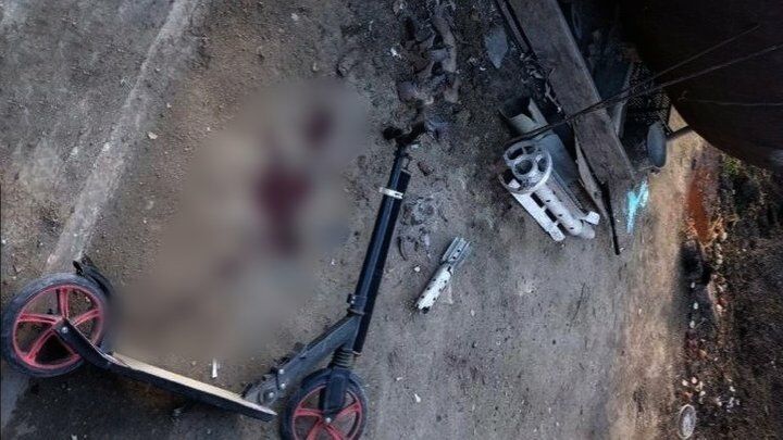 На Миколаївщині здетонував нерозірваний снаряд: постраждала дитина