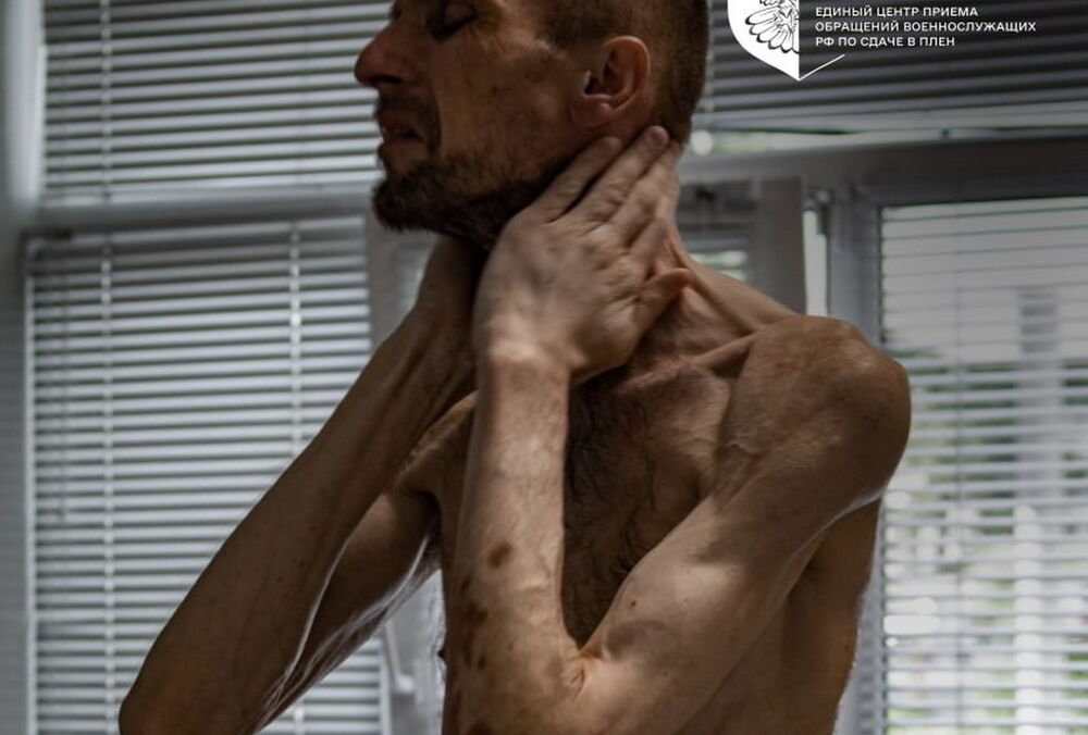 Росія доводить українських військовополонених до стану в'язнів концтаборів: фото