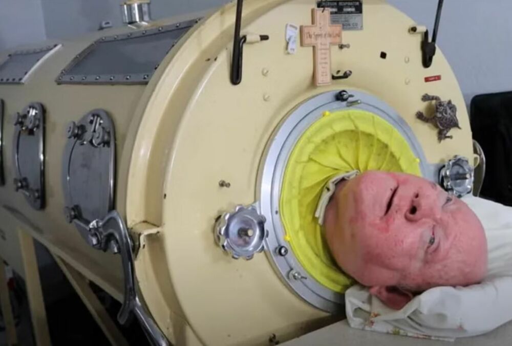 Умер Пол Александер - человек, который 70 лет прожил в капсуле ”железные легкие”