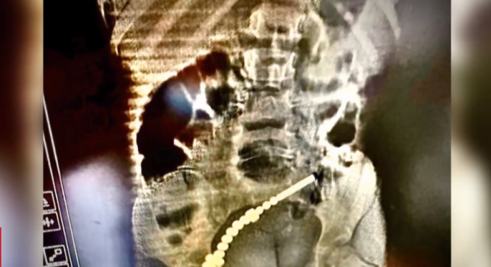 Во Львове девочка чуть не погибла из-за популярной игрушки, - ВИДЕО Во Львове девочка чуть не погибла из-за популярной игрушки, - ВИДЕО