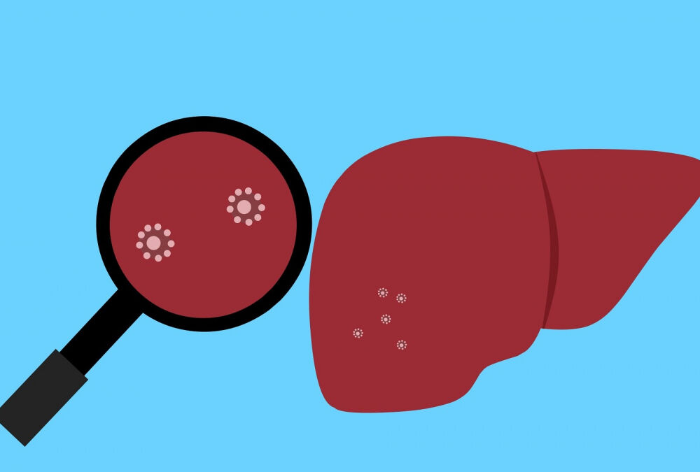 У Києві та області зареєстрували одразу 5 випадків гепатиту А