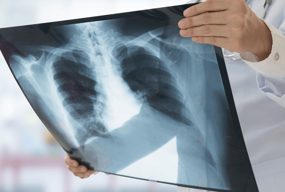 Эксперты прогнозируют вспышку смертельно опасных болезней в Украине