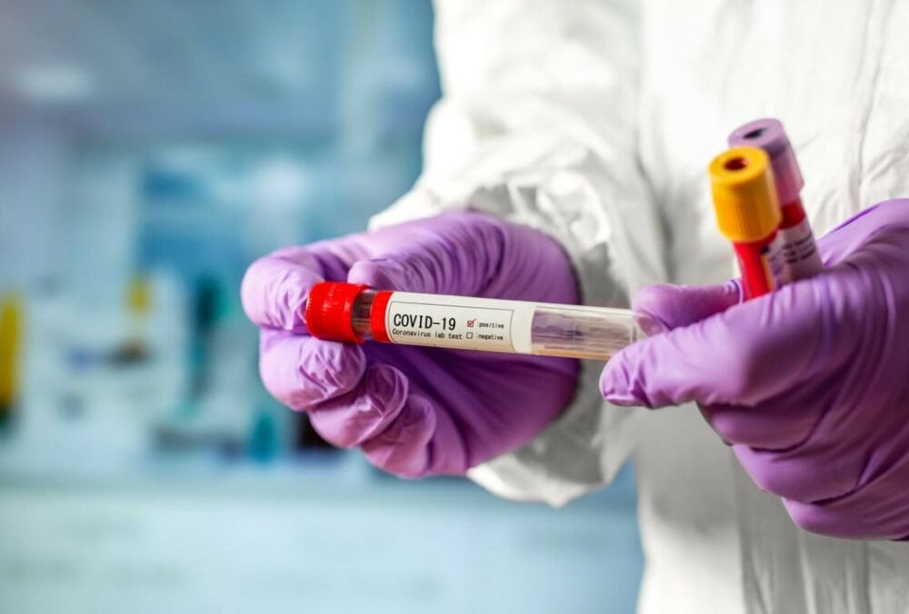 Ляшко рассказал, чем особенна нынешняя волна ковида 