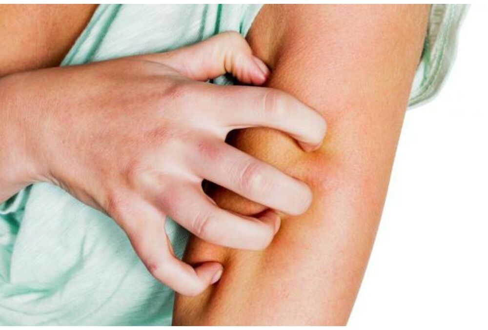 Американські медики назвали захворювання, яке підвищує ризик інсульту