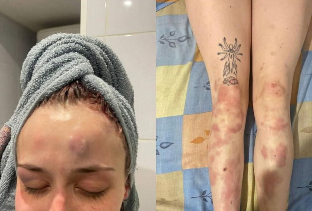 В Одесі представник ТЦК побив 19-річну дівчину, у відомстві заявили про початок перевірки: кадри