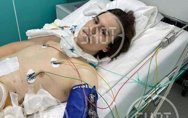 Розправа в Пермі: стало відомо про стан стрілка