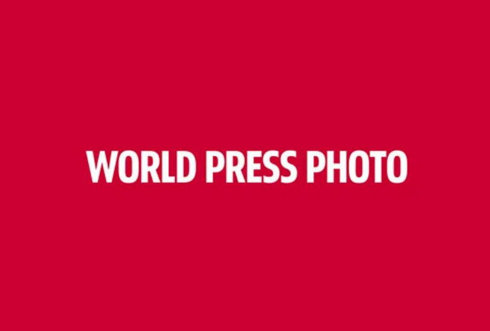 World Press Photo извинились за объединение фото травмированной украинской девочки и боевика ”ДНР”