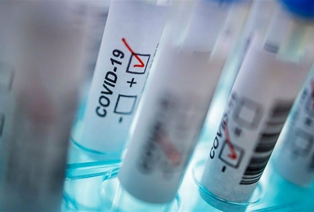 В Україні зафіксований новий антирекорд заражень COVID-19