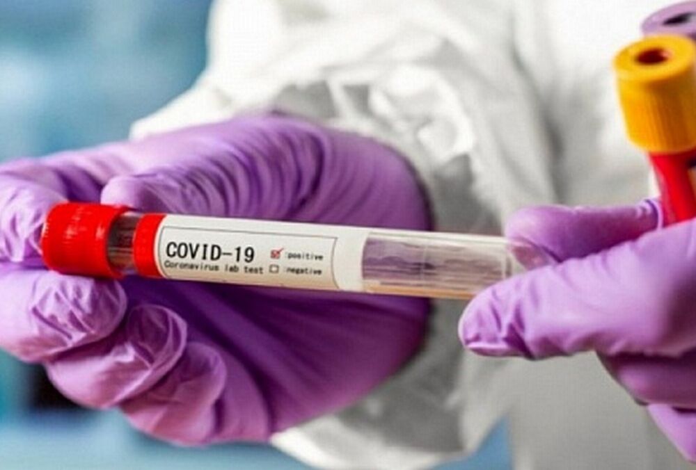 COVID-19 никуда не исчез: в Минздраве рассказали о ситуации с заболеванием