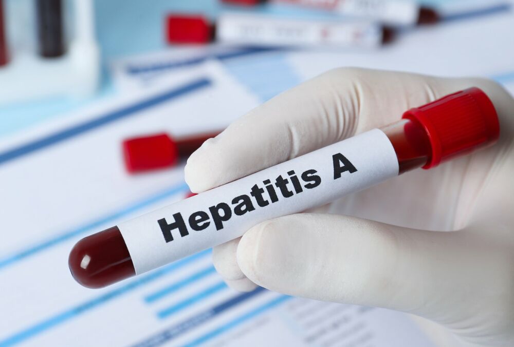 Спалах гепатиту А у Вінницькій області: кількість постраждалих росте