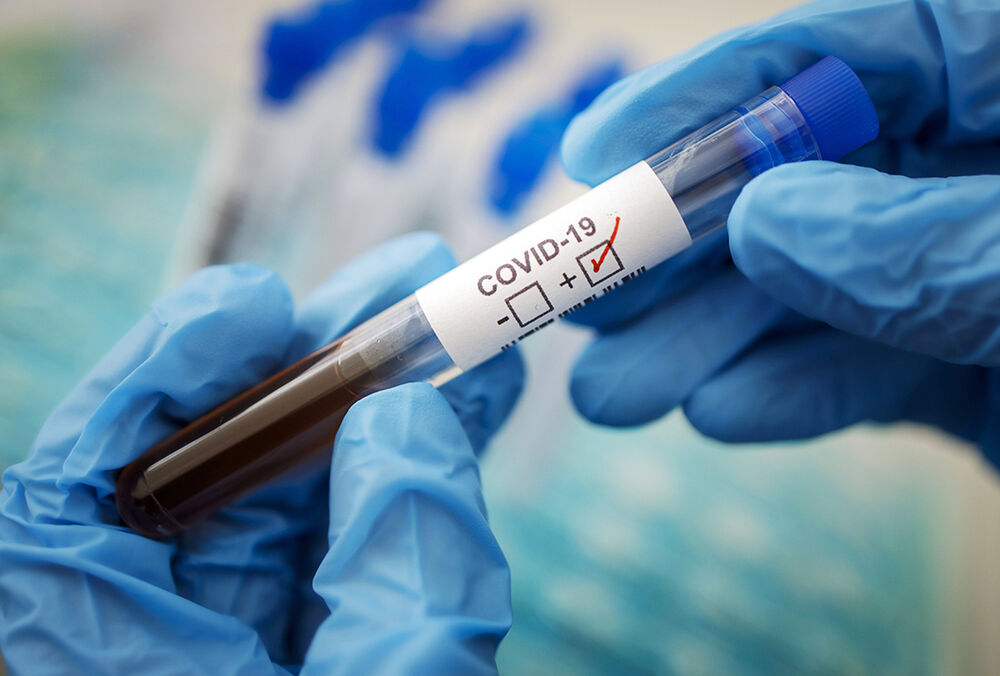 В Минздраве объяснили резкое снижение статистики Covid-19 в Украине В Минздраве объяснили резкое снижение статистики Covid-19 в Украине