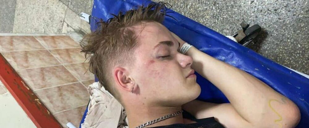 З Держохорони звільнили військового, який побив танцюриста Дорофеєвої