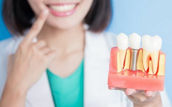 Показания и противопоказания к имплантации: когда стоит и когда нельзя устанавливать зуб