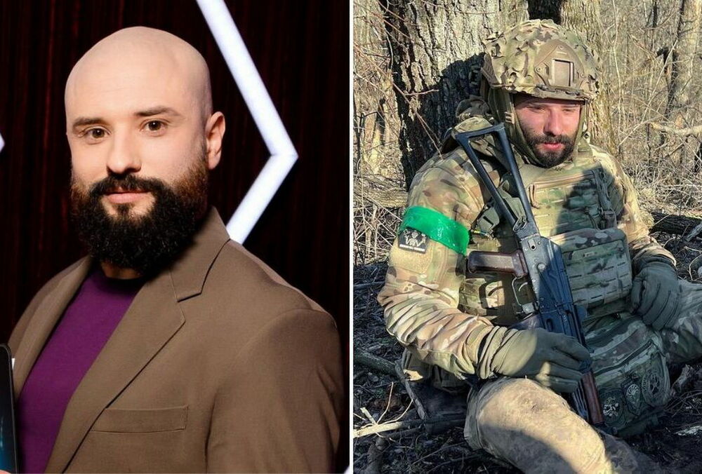 Віктор Розовий з ”Ліги сміху” показав гігантський шрам після поранення в голову