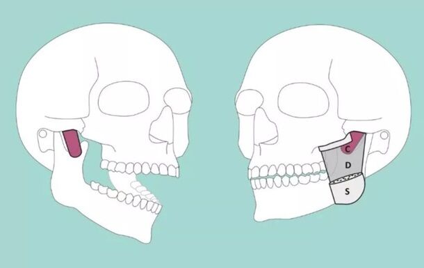 У тілі людини виявили новий м'яз
