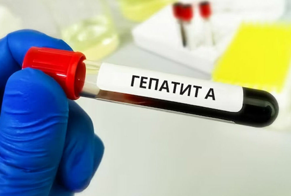 У Києві зафіксували спалах гепатиту А
