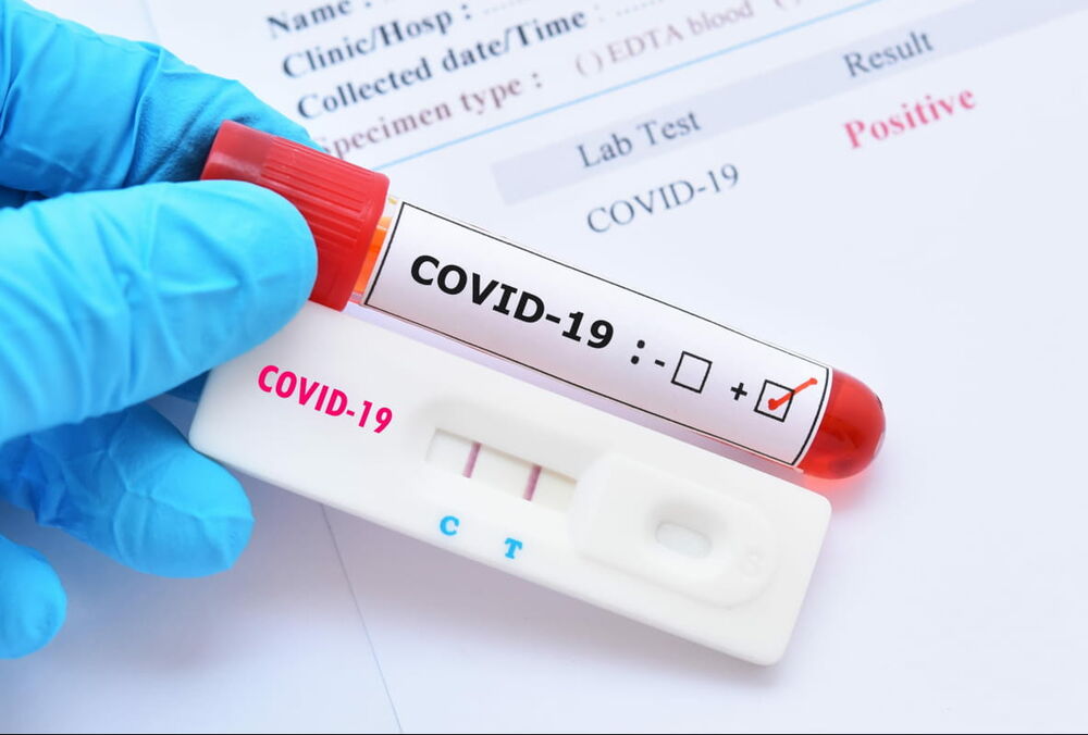 В ВОЗ спрогнозировали, когда ждать пика заболеваемости COVID-19 в Украине