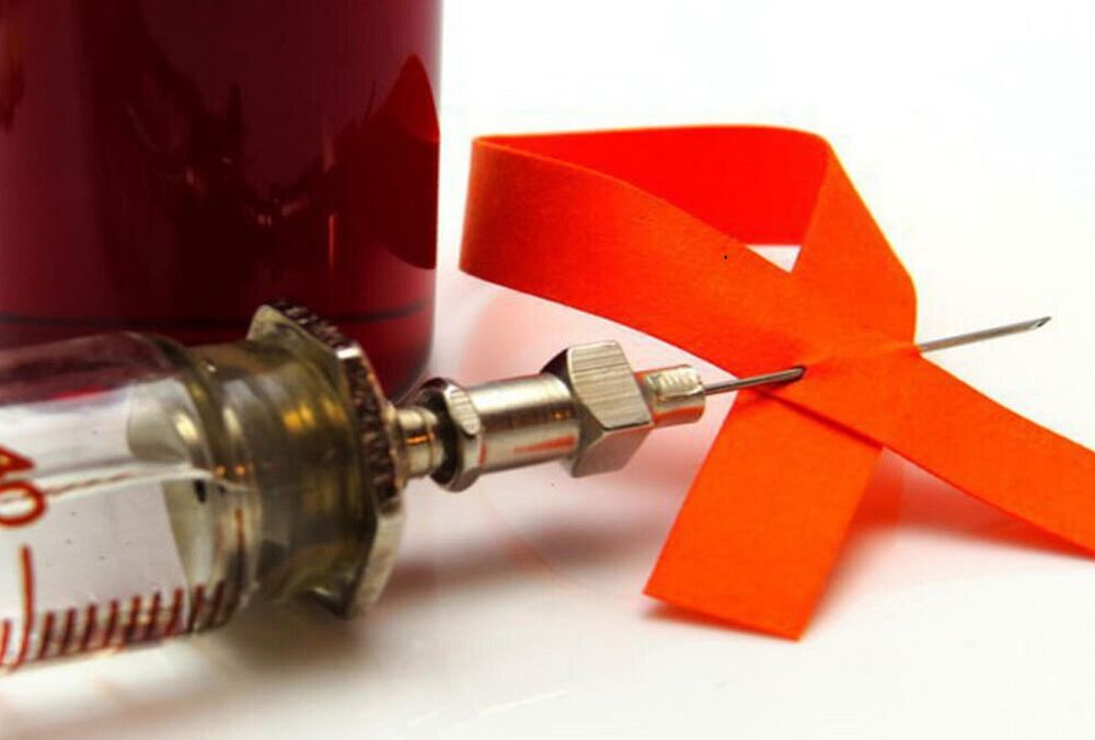 У США успішно завершили випробування вакцини від ВІЛ