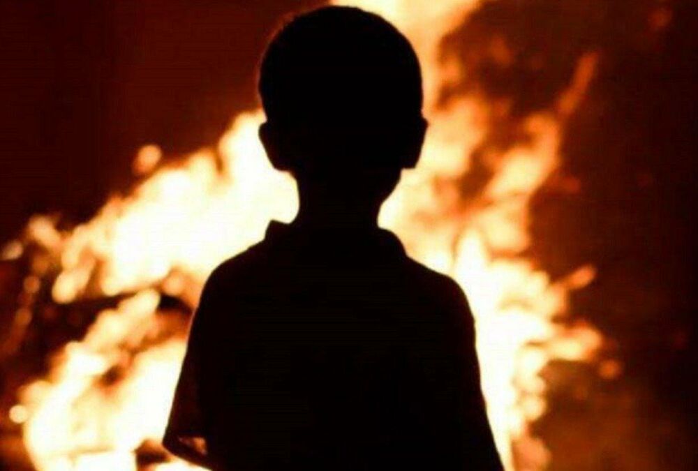 Бердянські школярі спалили приятеля заради відео для Instagram Бердянські школярі спалили приятеля заради відео для Instagram