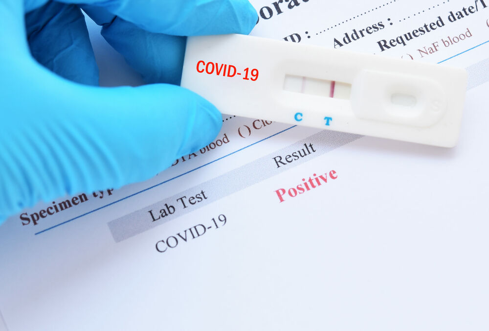 Киев решил отказаться от идеи массового тестирования на коронавирус