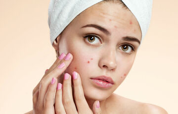 Нутрициолог назвала продукты, которые могут спровоцировать появление акне