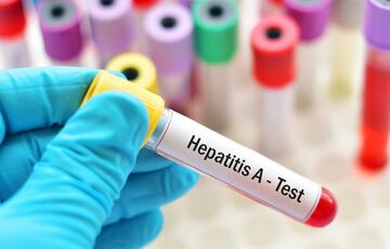 Спалах гепатиту у Вінницькій області: оголошено надзвичайну ситуацію, медики починають екстрену вакцинацію