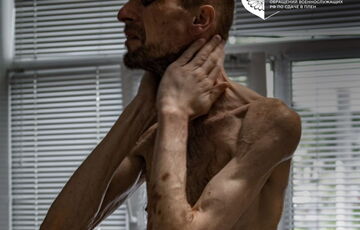 Росія доводить українських військовополонених до стану в'язнів концтаборів: фото