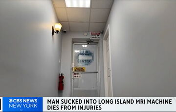 У США чоловіка з ланцюгом на шиї затягнув апарат МРТ, він загинув