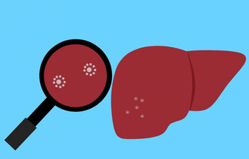 У Києві та області зареєстрували одразу 5 випадків гепатиту А