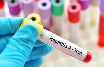 Спалах гепатиту А перекинувся на ще одну область