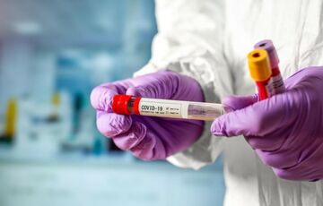 Ляшко рассказал, чем особенна нынешняя волна ковида  Ляшко рассказал, чем особенна нынешняя волна ковида