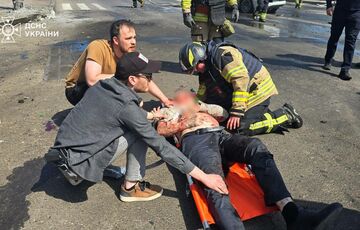 В больнице умер мужчина, который был ранен в ходе обстрела Харькова 22 апреля