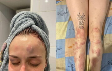 В Одессе представитель ТЦК избил 19-летнюю девушку, в ведомстве заявили о начале проверки: кадры  В Одессе представитель ТЦК избил 19-летнюю девушку, в ведомстве заявили о начале проверки: кадры