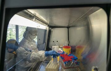 Коронавирус в Украине: число выявленных случаев после выходных упало Коронавирус в Украине: число выявленных случаев после выходных упало