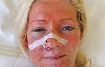 ”Ви з України?”: у Чехії чоловік побив двох жінок, уточнивши, звідки вони