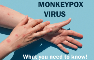 Чи є в Україні випадки віспи мавп