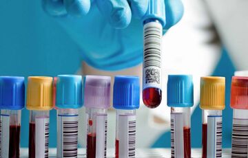 Ученые разработали анализ крови, который может предсказать развитие шизофрении