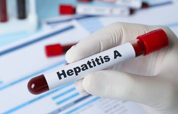 Вспышка гепатита А в Винницкой области: количество пострадавших растет
