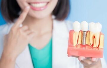 Показання та протипоказання до імплантації: коли стоїть та коли не можна встановлювати зуб