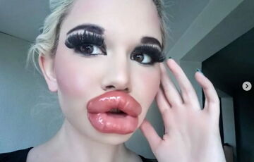 Дівчина витратила 10 тисяч доларів на найбільші губи у світі – ось, що з цього вийшло (фото)