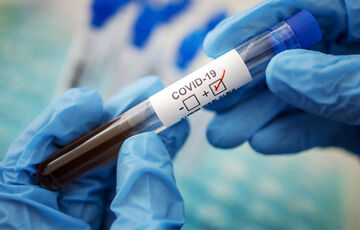 Ляшко назвав основний метод діагностики COVID-19 і запевнив, що всього достатньо