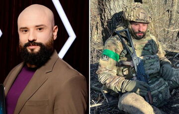 Виктор Розовый из ”Лиги смеха” показал гигантский шрам после ранения в голову Виктор Розовый из ”Лиги смеха” показал гигантский шрам после ранения в голову