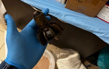 Лікарі дістали з тіла військового хвостовик міни – сапери дозволили (фото)