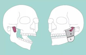 В теле человека обнаружили новую мышцу В теле человека обнаружили новую мышцу