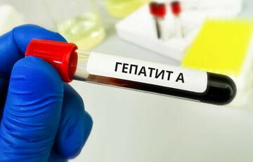 В Киеве зафиксировали вспышку гепатита А