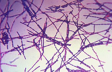 В Замбии начали гибнуть люди из-за вспышки сибирской язвы