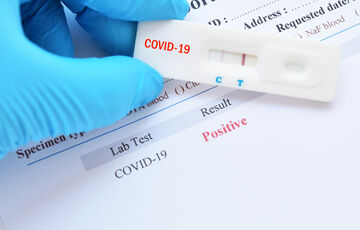 Київ вирішив відмовитися від ідеї масового тестування на коронавірус Київ вирішив відмовитися від ідеї масового тестування на коронавірус