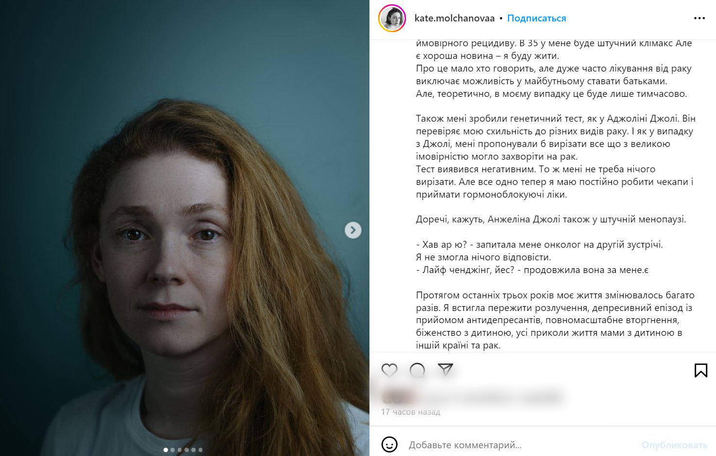 Известной украинской актрисе диагностировали рак — фото
