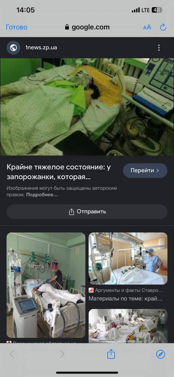 В Одесі після ракетного удару збирають гроші для лікування фейкової постраждалої — фото